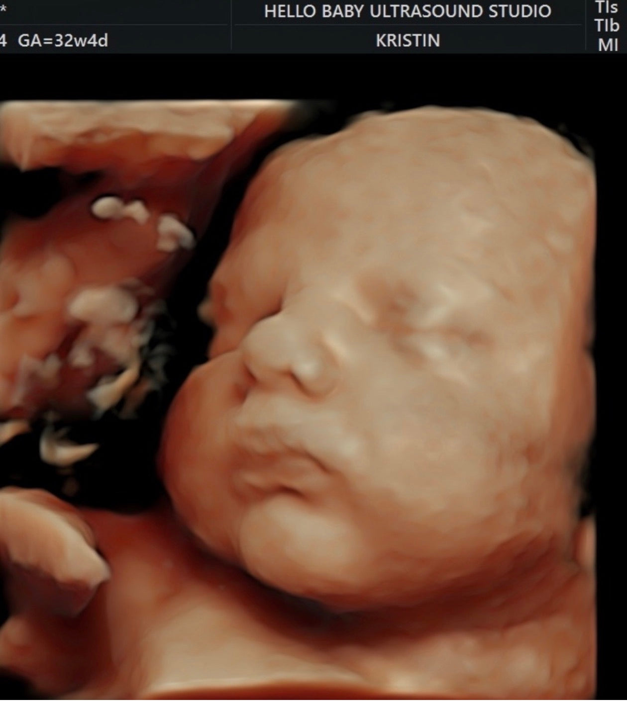 Oh Baby Baby Deposit