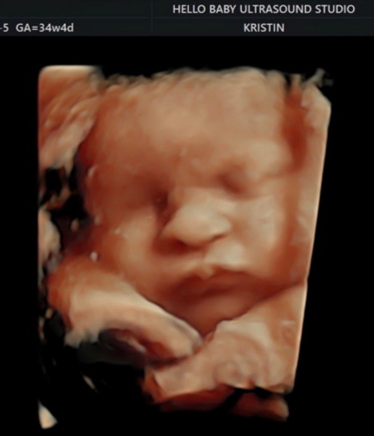 Baby Come Back Deposit